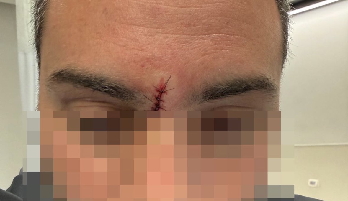 השוטר שנפצע מהגרזן