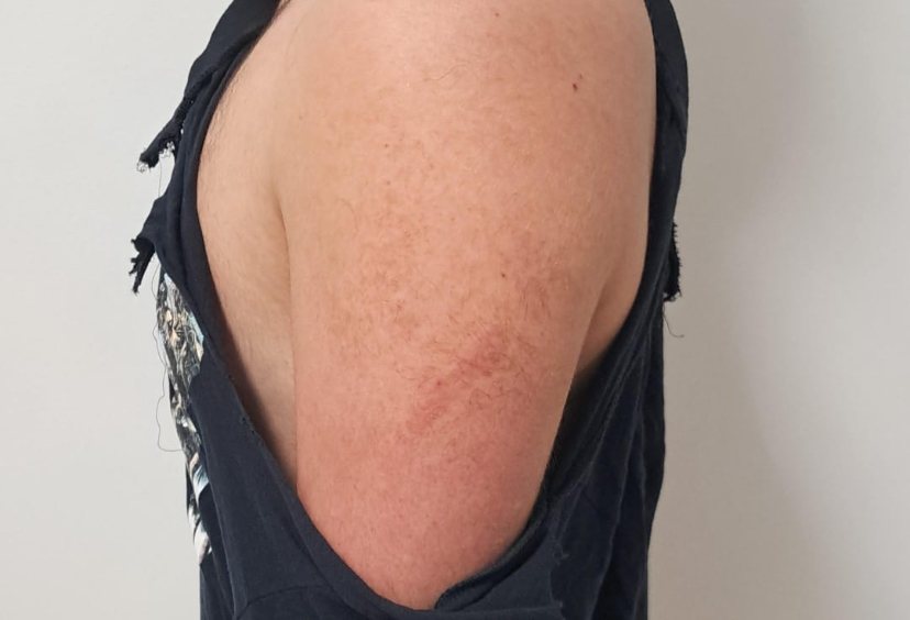 אחד הנערים אחרי התקיפה