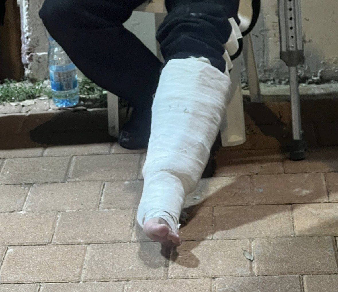 האוהד עם הגבס לרגלו