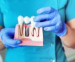 השתלות שיניים – כיצד לבחור רופא ומה חשוב לדעת?