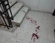 כתמי הדם בחדר המדרגות (צילום: שמואל סרדינס)